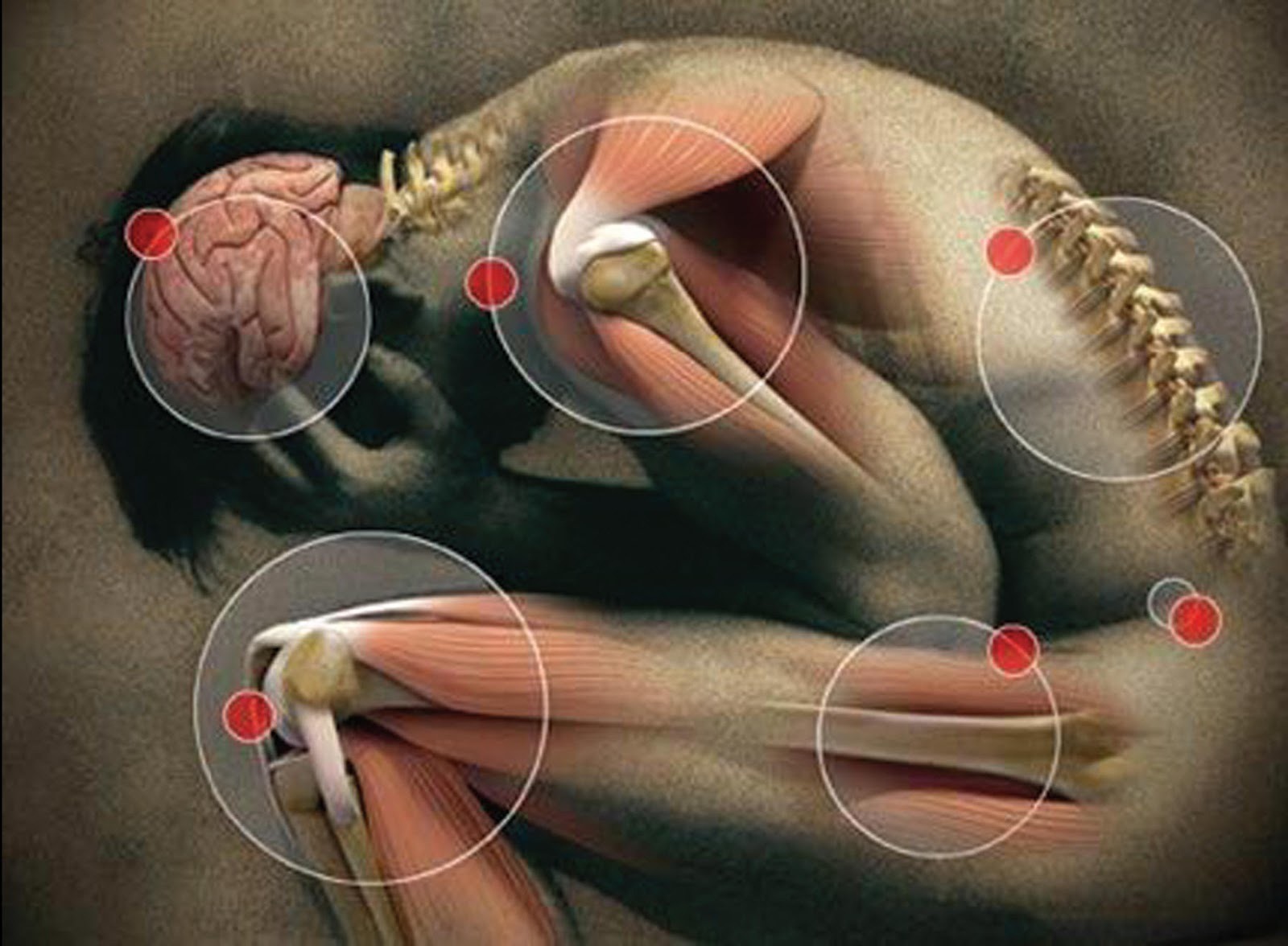 Quand la douleur modifie le cerveau